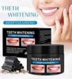 Teeth Whitening Deep Cleansing,, Douala, Cameroon Real Estate